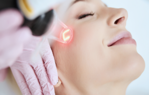 Definition and objective of the aesthetic laser of the face