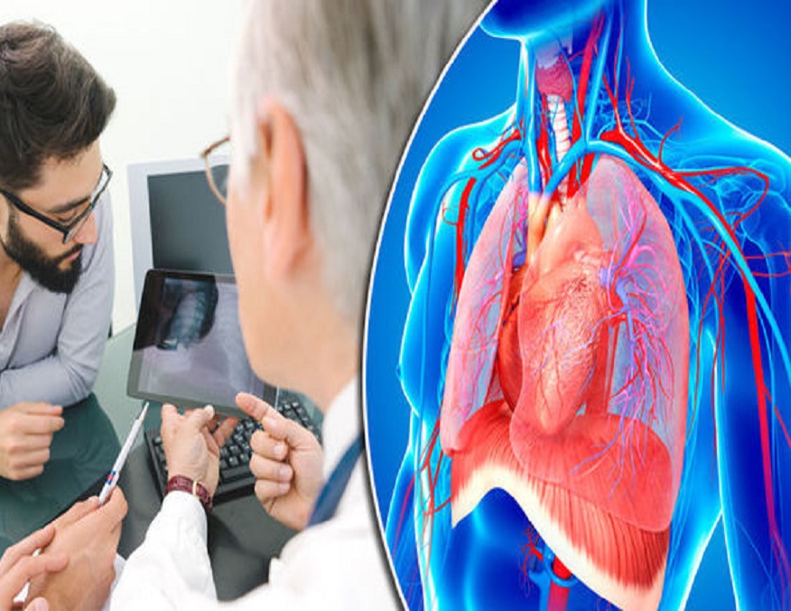 Chest Infections and Pneumonia Causes, Treatment, and Prevention Strategies
