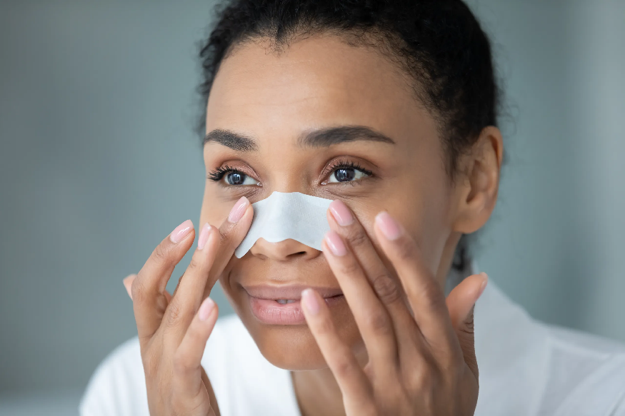 blackheads
